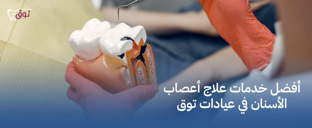 أفضل خدمات علاج أعصاب الأسنان في عيادات توق