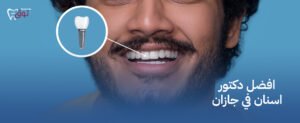 افضل دكتور اسنان في جازان – علاج احترافي لجميع مشاكل الأسنان