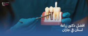 افضل دكتور زراعة اسنان في جازان – جودة ومصداقية
