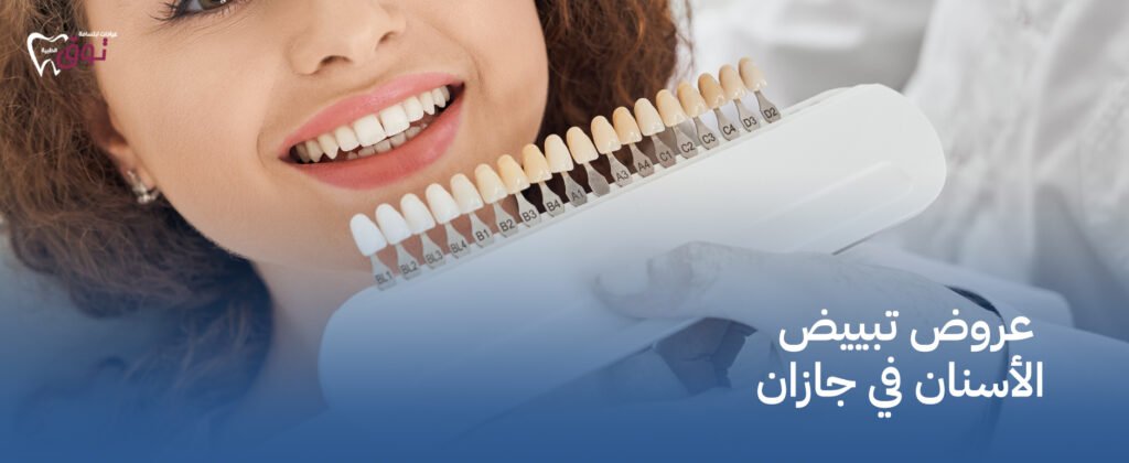 عروض تبييض الأسنان في جازان | ابتسامة ناصعة بأفضل الأسعار