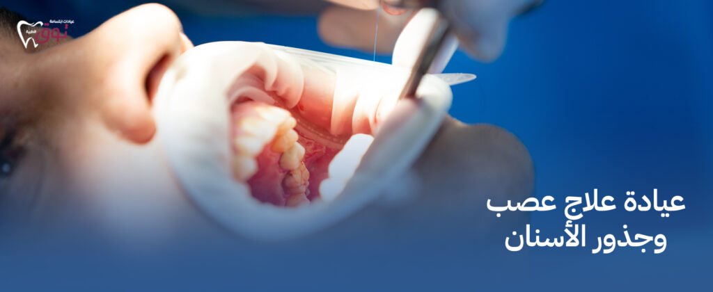 عيادة علاج عصب وجذور الأسنان , بأحدث التقنيات في عيادتنا