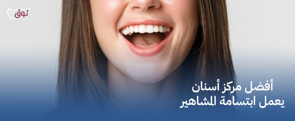 أفضل مركز أسنان يعمل ابتسامة المشاهير – احجز الآن
