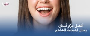 أفضل مركز أسنان يعمل ابتسامة المشاهير – احجز الآن