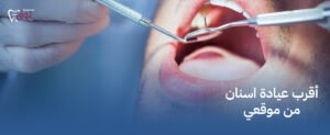 أقرب عيادة اسنان من موقعي – احجز الآن