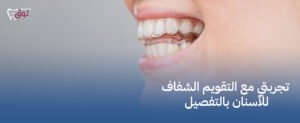 اكتشف سر ابتسامة مثالية – تجربتي مع التقويم الشفاف للأسنان بالتفصيل