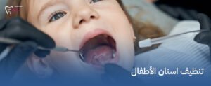 تنظيف اسنان الأطفال – ابتسامة صحية لأطفالك تبدأ هنا