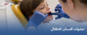 حشوات الاسنان للاطفال – راحة وحماية بأسلوب لطيف