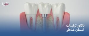 دكتور تركيبات اسنان شاطر – ابتسامة جديدة 2025
