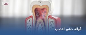 فوائد حشو العصب – ابتسامة خالية من الألم تبدأ اليوم
