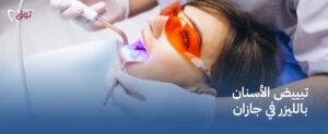 تبييض الأسنان بالليزر في جازان | ابتسامة مشرقة بأحدث التقنيات