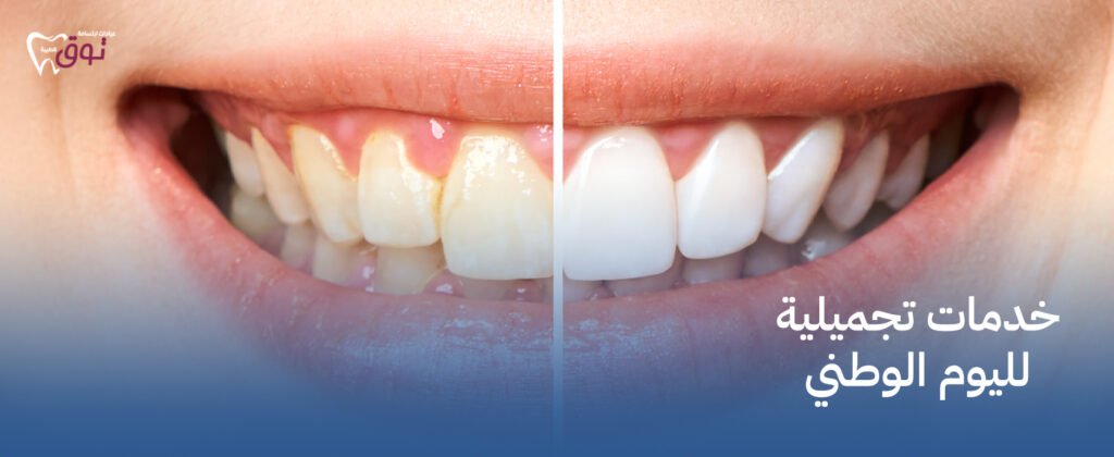 خدمات تجميلية لليوم الوطني – اجعل يومك مميزًا مع أفضل العروض