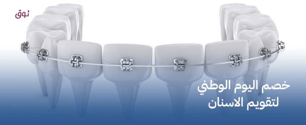 خصم اليوم الوطني لتقويم الاسنان – ابتسامة مثالية مع عروض اليوم الوطني