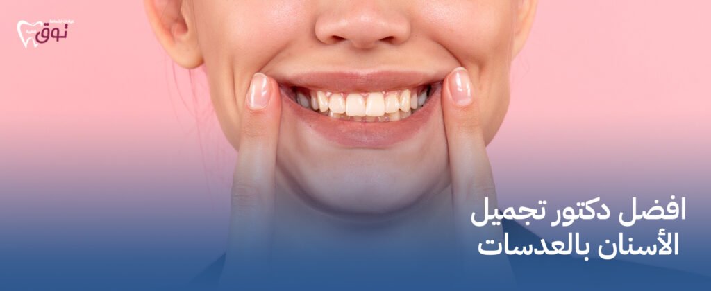 افضل دكتور تجميل الأسنان بالعدسات | ابتسامة هوليوودية بأحدث التقنيات